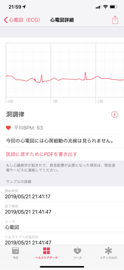 Apple Watch 心電図(ECG)アプリ機能レビュー 11