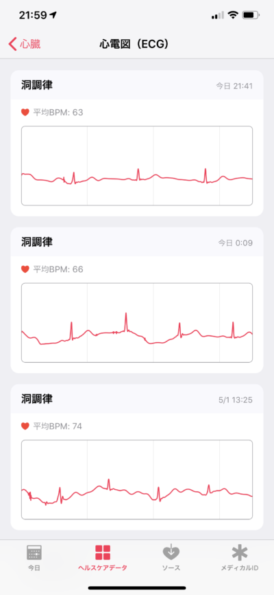 Apple Watch 心電図(ECG)アプリ機能レビュー 9